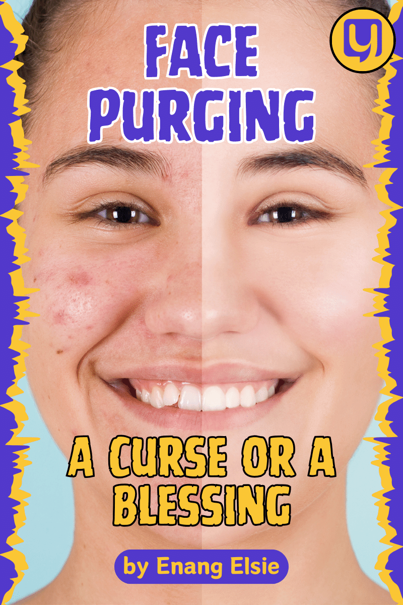 Face Purging: A Curse or a Blessing